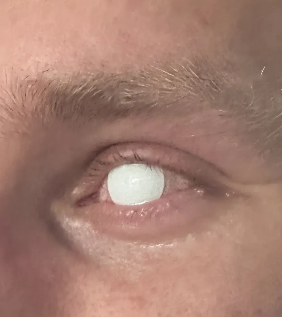 Crazylinser Blind White