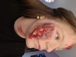 Kryolan Koagulerat Blod