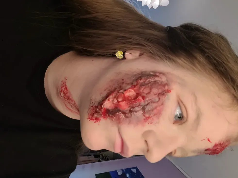 Kryolan Koagulerat Blod