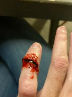 Kryolan Koagulerat Blod
