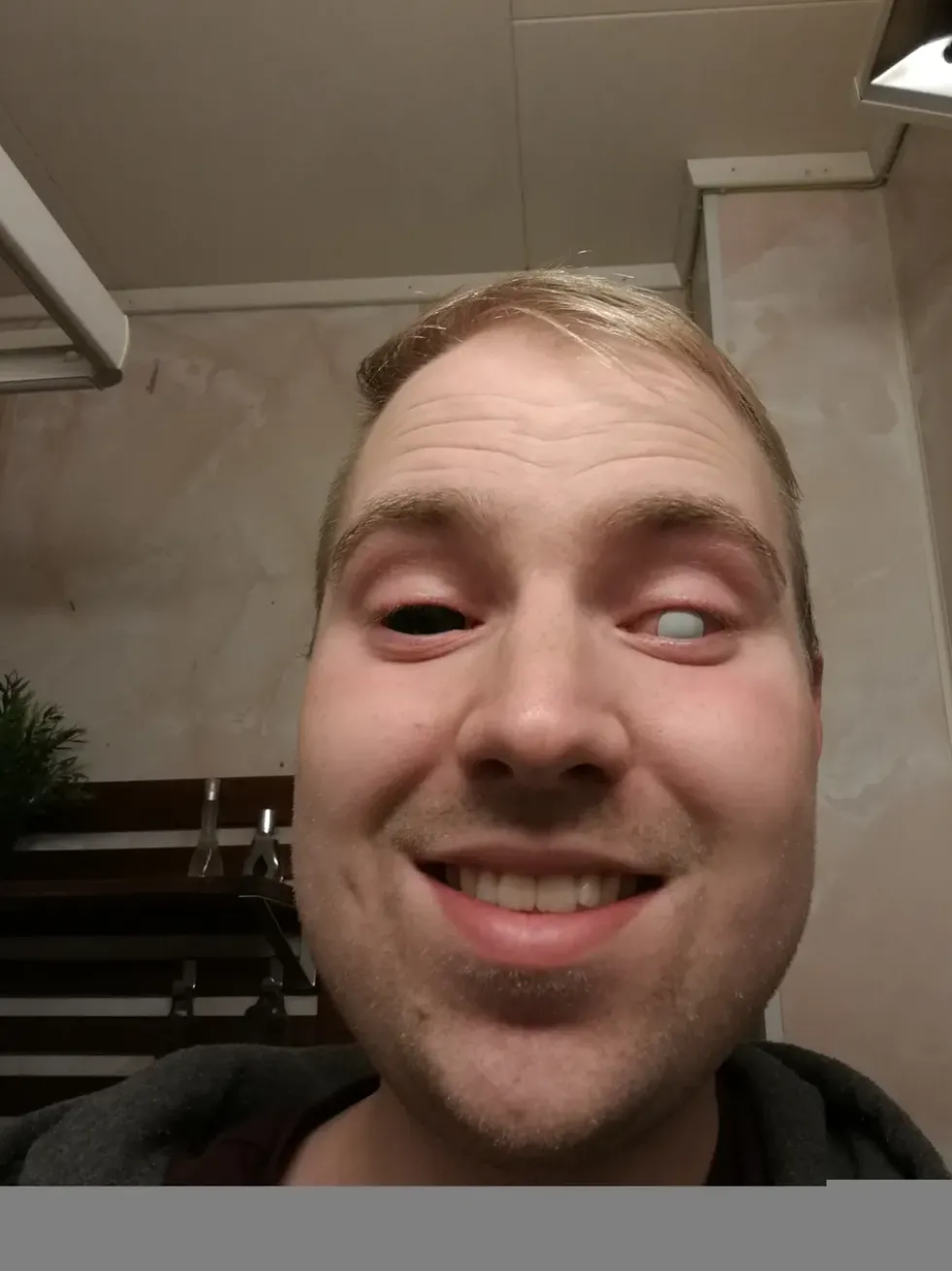 Scleralinser Svart